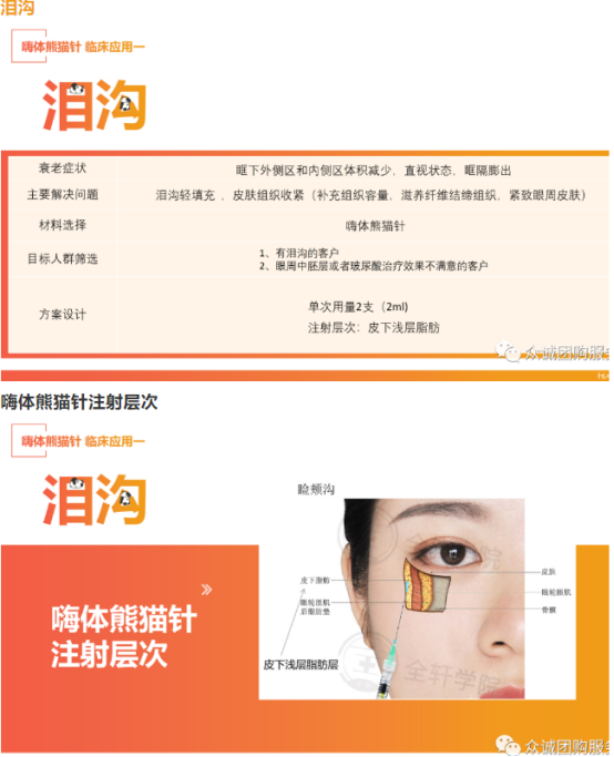 嗨体熊猫针是什么? 嗨体熊猫针是什么?