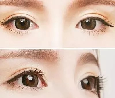 东方人眼部美的特征-客服系统|永州博美医疗美容医院|官方网站