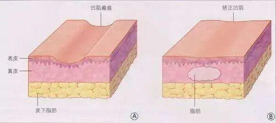 这些抗衰医美项目，让你比同龄人看起来年轻10岁！