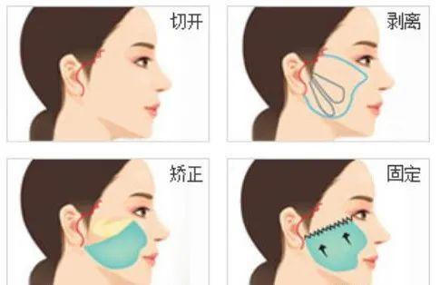 这些抗衰医美项目，让你比同龄人看起来年轻10岁！
