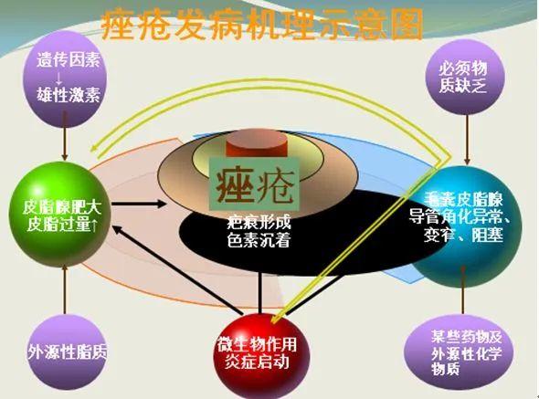 治痘痘全详细攻略,建议收藏! 治痘痘全详细攻略,建议收藏!