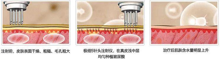 科普:春季换季品项选择菜单之一 科普:春季换季品项选择菜单之一