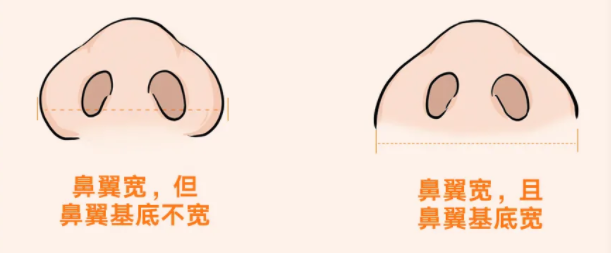 科普：鼻部整形的8大美学标准