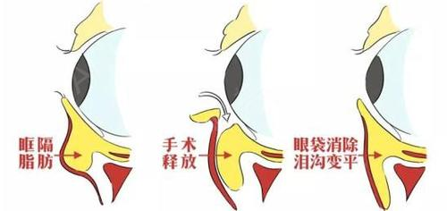 科普：眼部10大美学标准 | 附美眼方案