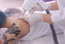 注意！这些人不适合做激光祛斑-客服系统|永州博美医疗美容医院|官方网站