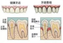 牙缝太大可以补吗？矫正还是贴面呢？-客服系统|永州博美医疗美容医院|官方网站