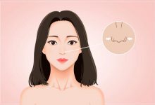 科普一下三种宽鼻子的解决办法-客服系统|永州博美医疗美容医院|官方网站