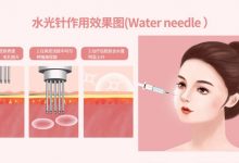 水光针、微针有什么区别?哪种适合你?术后该如何做才能效果翻倍?-客服系统|永州博美医疗美容医院|官方网站