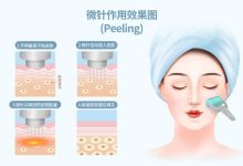 哪些医美项目可以长期做?-客服系统|永州博美医疗美容医院|官方网站